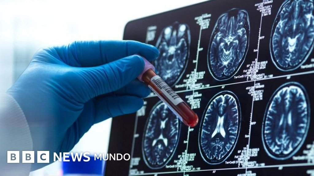 Cuatro desarrollos prometedores en la lucha contra el Alzheimer este año.