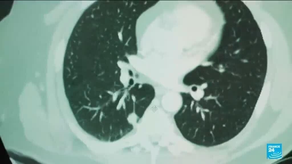 Scientists employ artificial intelligence for cancer detection.