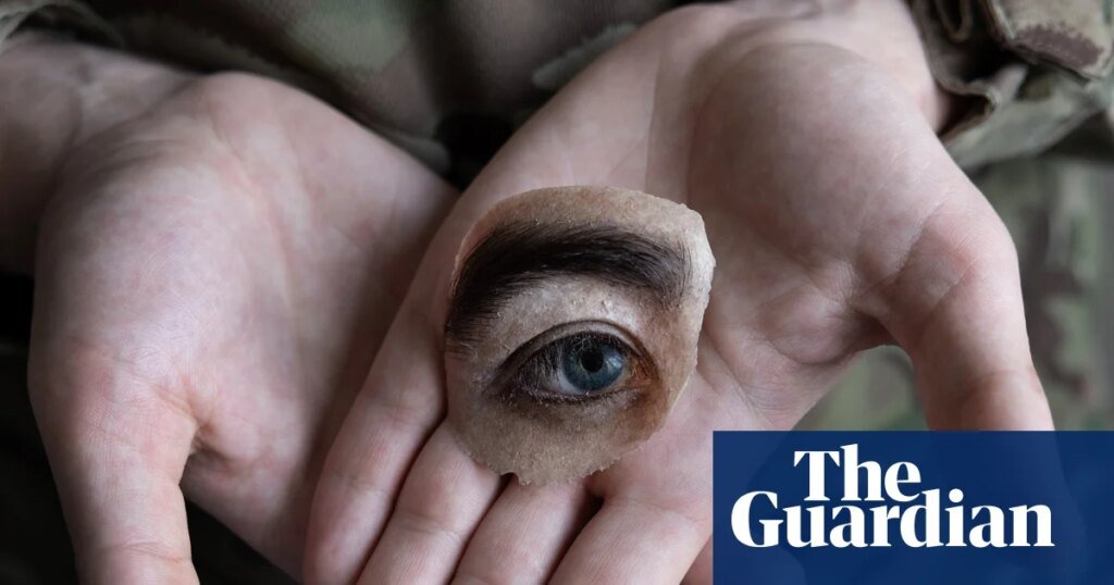 War's Hidden Toll: A Visual Report on the Aftermath of Injuries in Ukraine